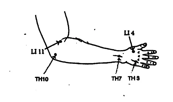 Diagram showing acupuncture points on the arm and hand.